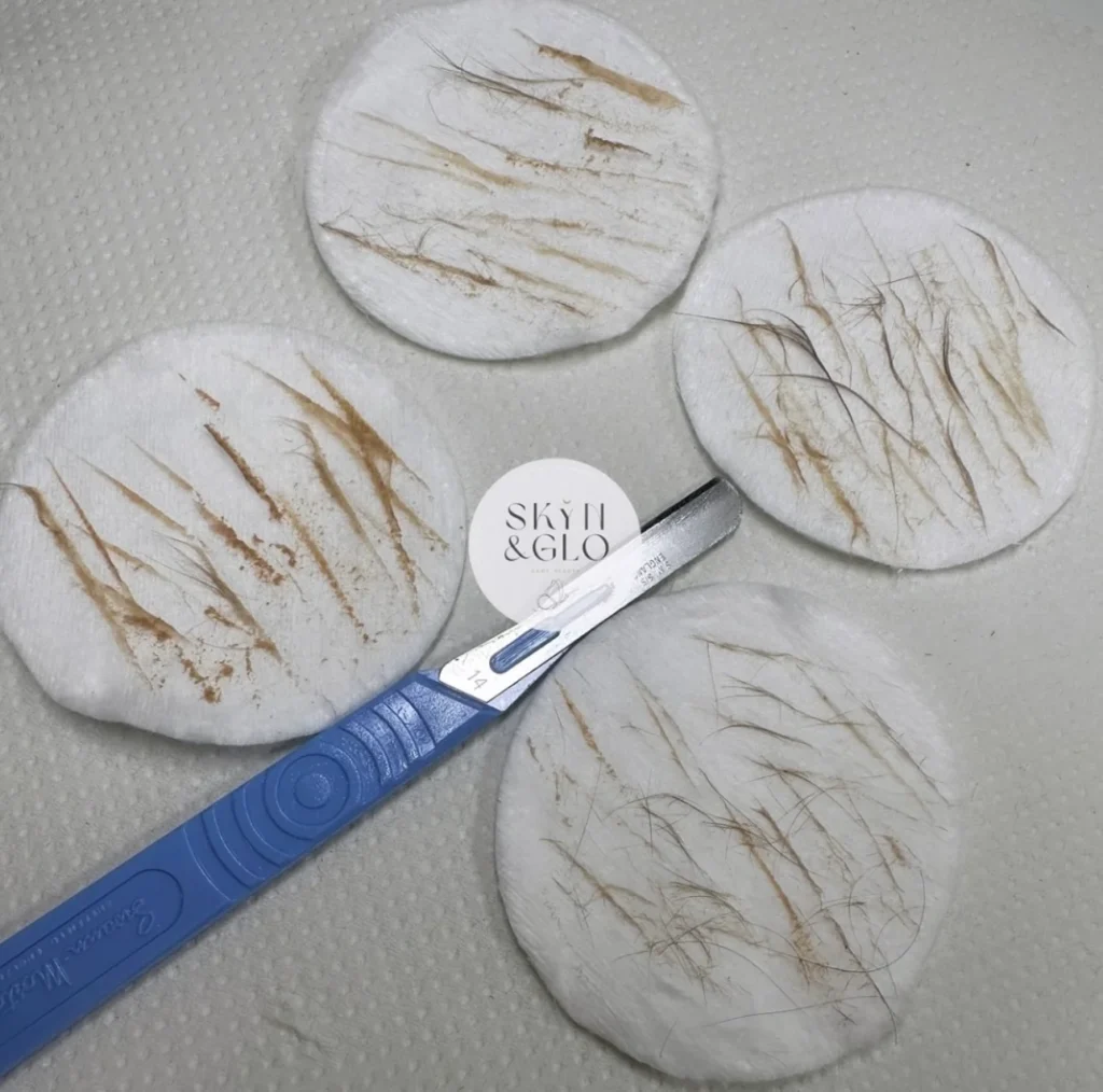 Cotton pads showing the result of a classic dermaplane treatment