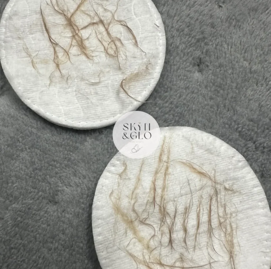 Cotton pads following Deluxe Dermaplane treatment