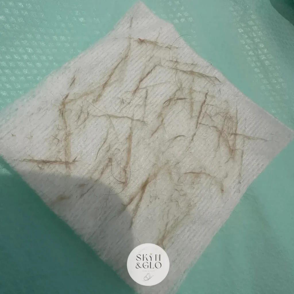 Cotton pads showing the results Dermaplane and peel treatment