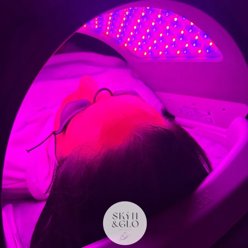 During a Lite Peel LED light therapy treatment