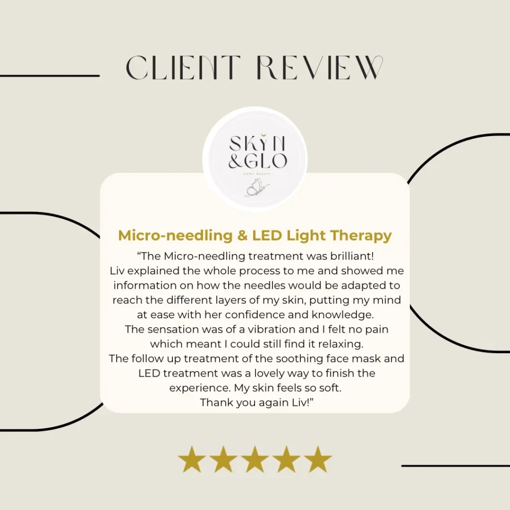 Client review of Microneedling treatment